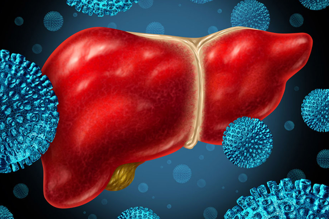 Hepatitis en la Región Andina